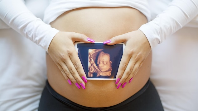 Pregnant woman holding a 3D ultrasound on her stomach