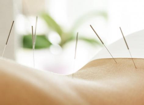 How do we make acupuncture effective?

