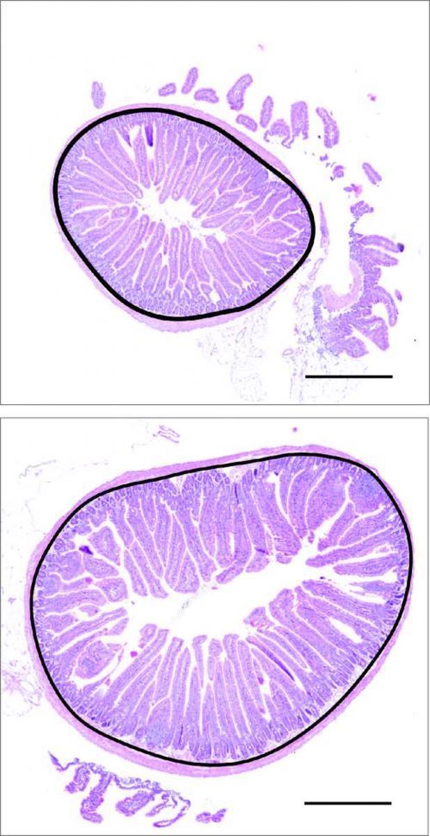 Sections of mouse intestine.  Above, normal intestinal circumference (in black) and villi (in pink).  Below, the intestine is enlarged after overeating with obesity, with a larger circumference and longer villi.