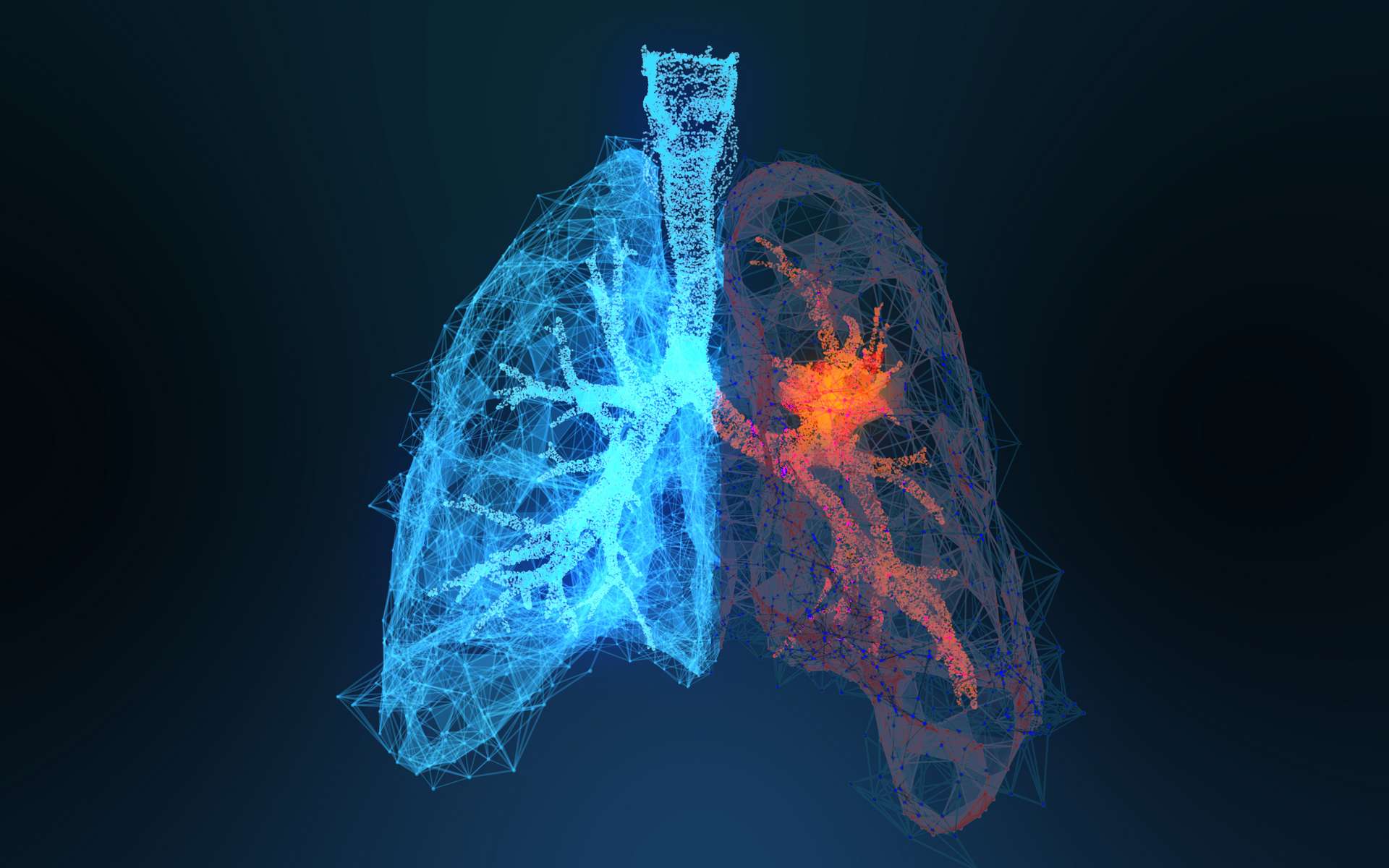 Les cas de cancer du poumon sont en augmentation chez les femmes et les non-fumeurs. © appledesign, Adobe Stock