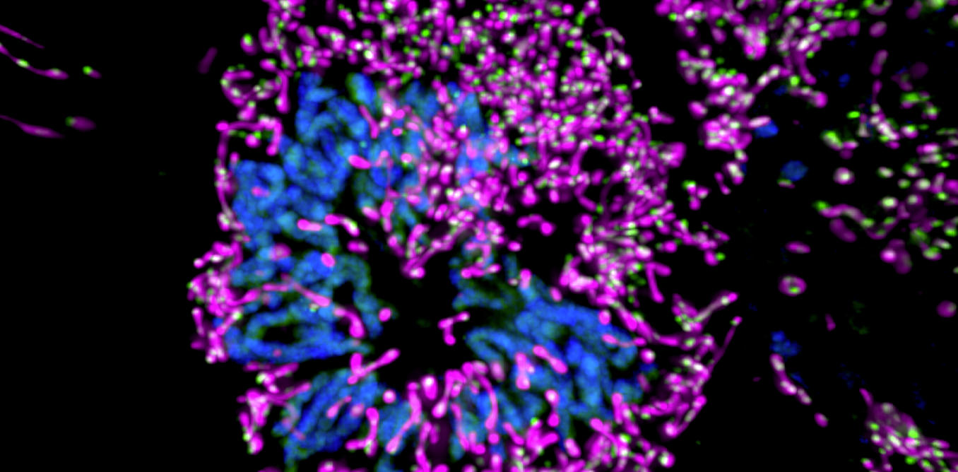 Mitochondrial dynamics illuminated by fluorescence microscopy

