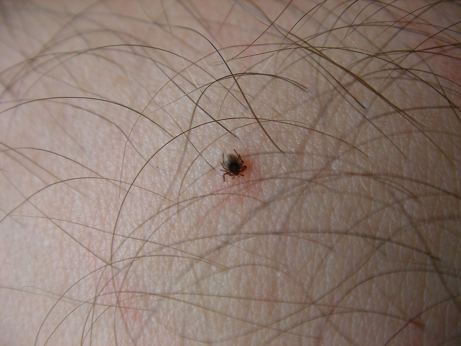 These are the 5 places where you risk getting bitten by a tick

