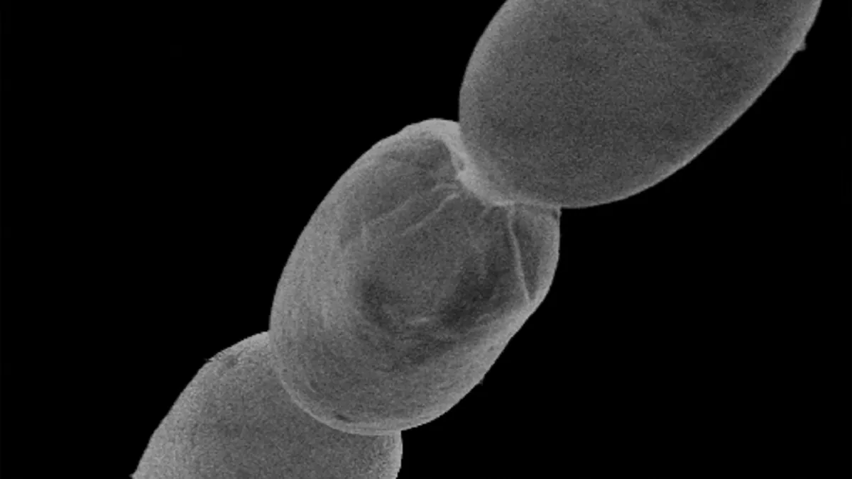Discover the largest bacteria in the world

