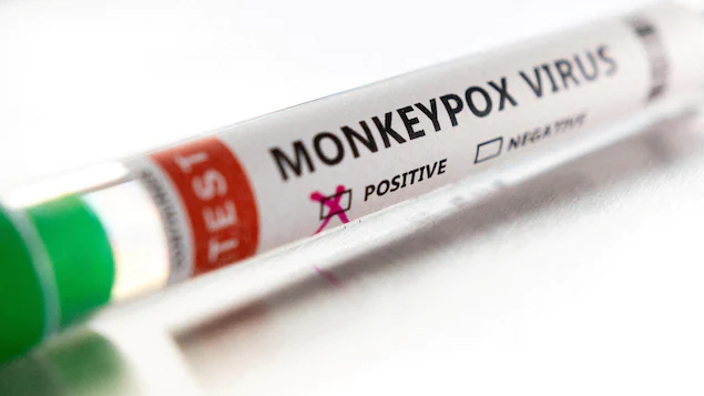 Experts say measures are needed to reduce monkeypox cases

